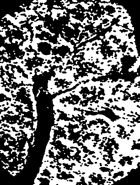 Binary Threshold